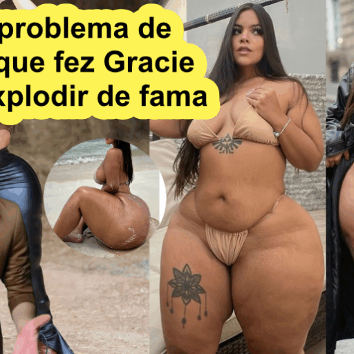 O raro problema de saúde que fez Gracie Bon explodir de fama